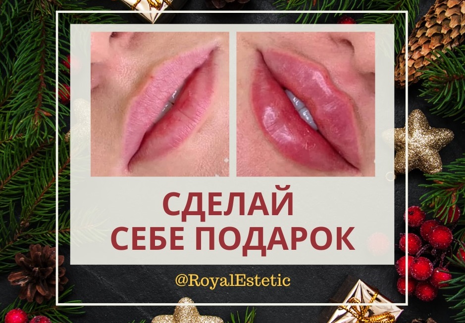 Royal Estetic